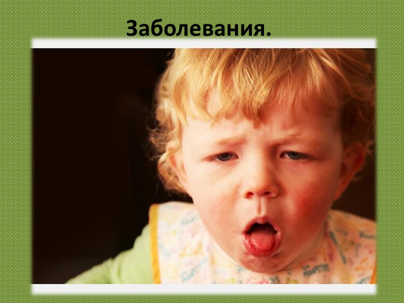 Заболевания.  Коклю́ш— острая антропонозная воздушно-капельная бактериальная инфекция, наиболее характерным признаком которой является приступообразный